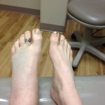 Tales of a Broken Talus – Update #1