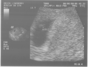 J-bean's first photos at 6 weeks pregnant in early August!