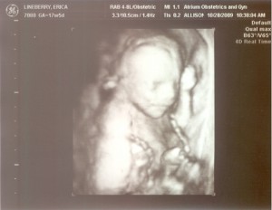 Our 18 week anatomy scan was in late October - that's when we found out our little jellybean was blue!